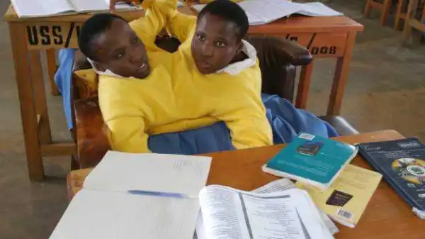 19-Year-Old Conjoined Twins Who Refused To Be Separated Set To Become Graduates {Photos}